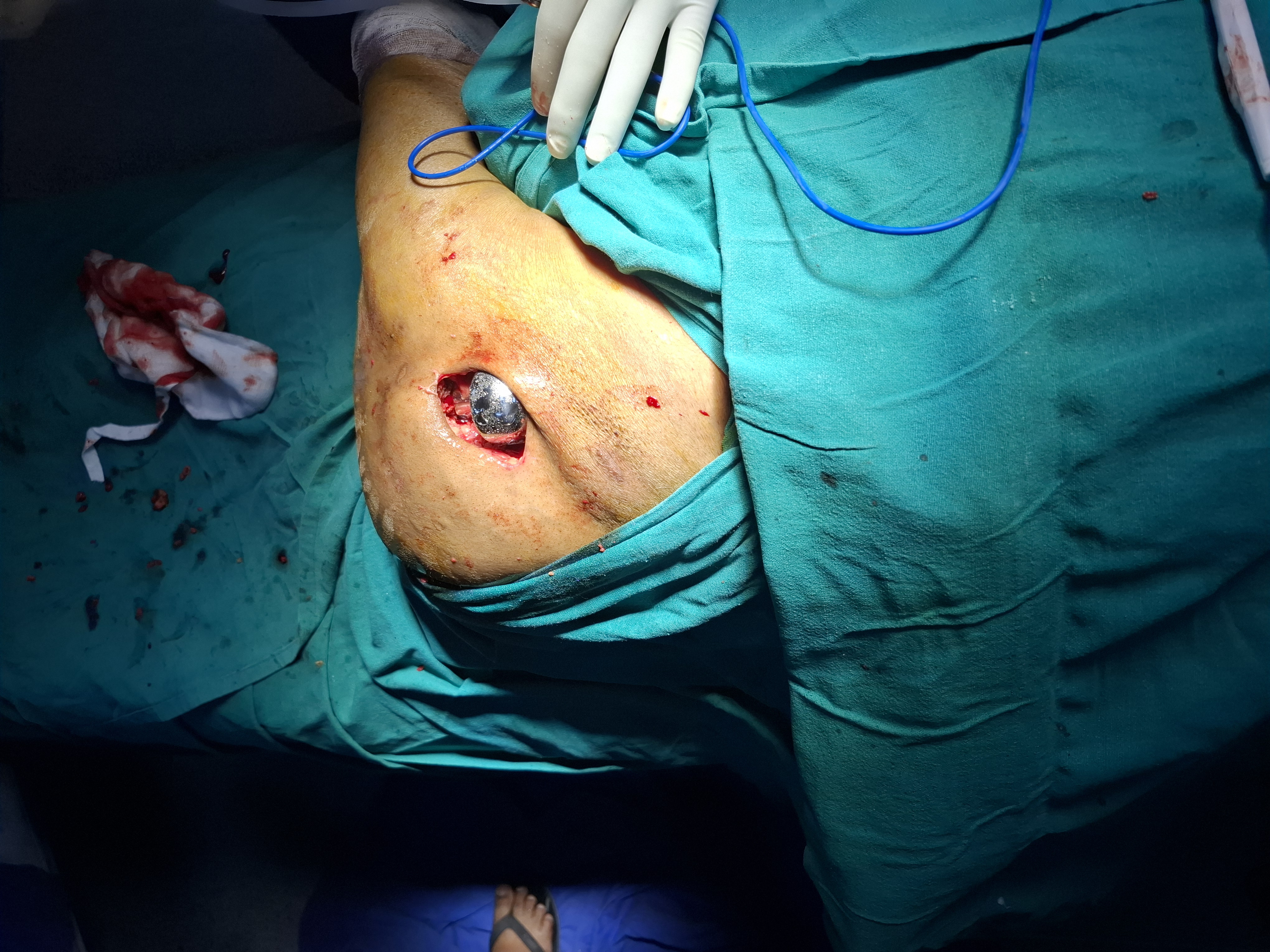 Ligament Surgeon in Patna- Olive Hospital - Dr Kumar Gaurav